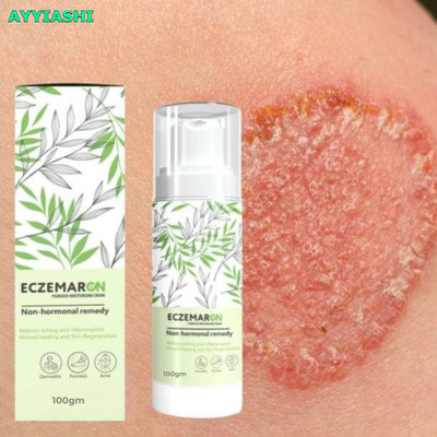 AYYIASHI Eczemaron Herbal Spray For Men’s Psoriasis & Skin Care Liquid(100 ml)