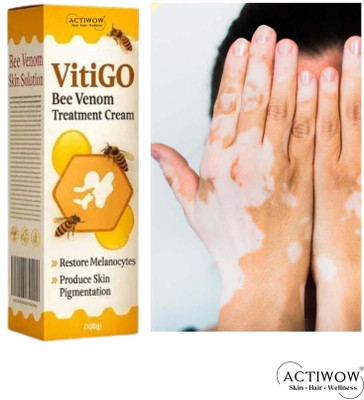 ACTIWOW Vitigo Bee Venom Cream for Glow Enhancing Daily Cream PR01 A01 Cream(100 g)