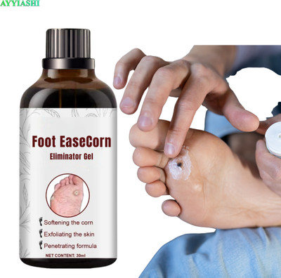 AYYIASHI Corn Remover Gel Professional Foot Care Pack Easy Use Liquid(30 ml)