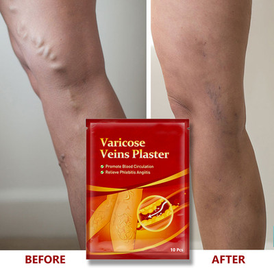 BEUTISKY Herbal Patches – Anti-Inflammatory Plaster for Varicose Vein Treatment Plaster & Patch(10 x 10 g)