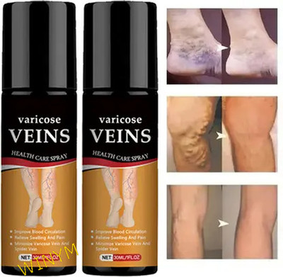 Winym Varicose Vein Relief Spray – Natural Cooling Effect Pack of 2 Spray(2 x 100 ml)