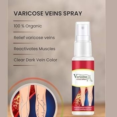 SHEFFO Healing Varicose Veins Treatment Spray Spray(100 g)