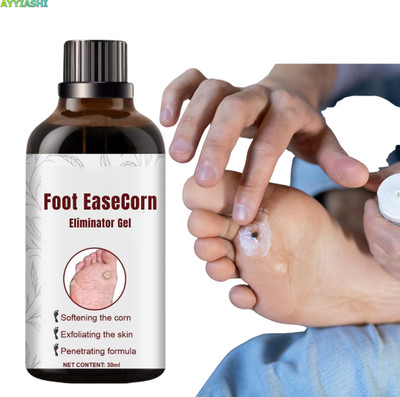 AYYIASHI Corn Remover Gel Fast Relief Safe Daily Use Pack Liquid(30 ml)