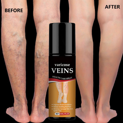 house of common Natural Herbal Spray – Varicose Veins Pain Relief & Leg Care Spray(30 ml)