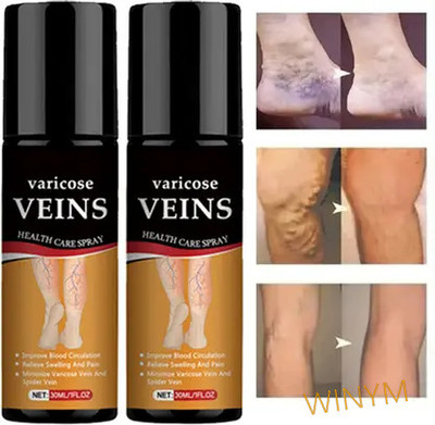 Winym Varicose Vein Relief Spray – Cool Vein Solution Pack of 2 Spray(2 x 100 ml)