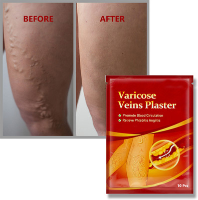 house of common Varicose Vein Healing Plaster – For Heavy & Achy Legs Plaster & Patch(10 x 10 g)