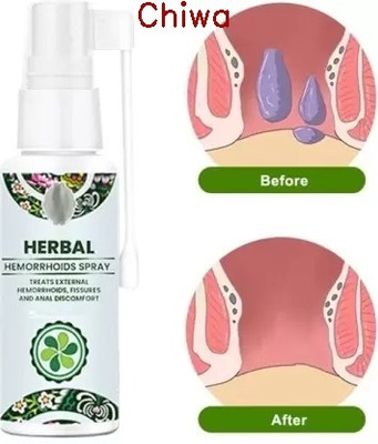 CHIWA CalmHerb Piles Spray: Natural and Soothing Relief from Hemorrhoids Spray(50 ml)