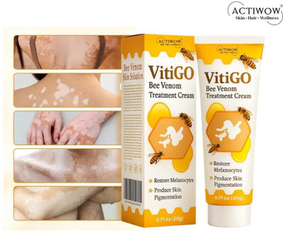 ACTIWOW Vitigo Bee Venom Cream for Upper Body Care Z01 Cream(100 g)