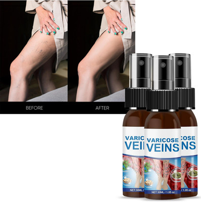 house of common | Natural Leg Care Solution|Soothes Tired Legs & Reduces Spider Veins Spray(3 x 30 ml)