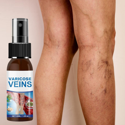 house of common Varicose Vein Pain Relief Spray – Herbal Soothing Leg Care Spray(30 ml)