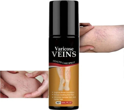 Vishmart Varicose Veins Revitalization Spray Herbal Treatment Pain Relief Spray(30 ml)