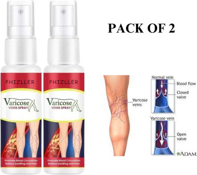 PHIZLLER Advanced Varicose Vein Treatment Spray HERBAL Healing Varicose Veins Spray Spray(2 x 100 ml)
