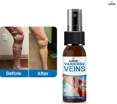 LORSHEL Vericose Vein Spray - Reduces Swelling for Premium Quality Spray(30 ml)