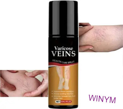 Winym Varicose Vein Cooling Mist For Comfort Spray(100 ml)