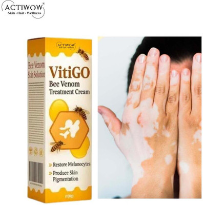 ACTIWOW Vitigo Bee Venom Cream for Skin Recovery Support Cream PR01 Cream(100 g)