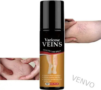 venvo Natural Cooling Varicose Vein Mist For Comfort Spray(100 ml)