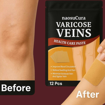 Naosucura Effective Relief Varicose Veins Care Patches for Pain and Blood Flow Support Plaster & Patch(12 Patches)