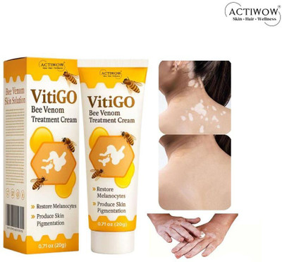 ACTIWOW Vitigo Bee Venom Cream for Quick Softness Boost Z01 Cream(100 g)