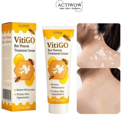 ACTIWOW Vitigo Bee Venom Cream for Smoother Smile Lines Z01 Cream(100 g)