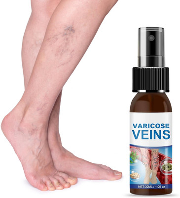 house of common Natural Varicose Vein Relief – Anti-Inflammatory Spray for Legs Spray(30 ml)
