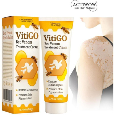 ACTIWOW Vitigo Bee Venom Cream for All-Natural Glow Cream PR01 A01 Cream(100 g)