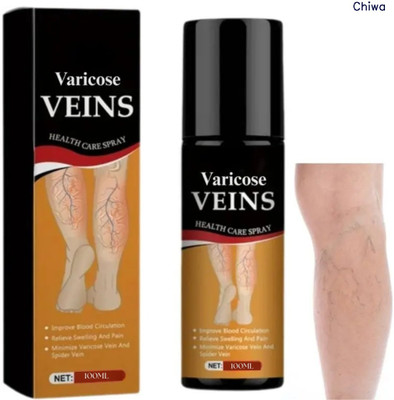 CHIWA Vericos Spray | Easy Herbal Comfort For Sore Aching Legs Spray(100 ml)