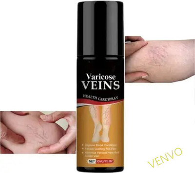 venvo Fast Absorbing Varicose Vein Relief Mist Spray(100 ml)