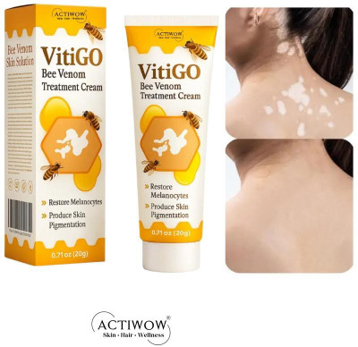 ACTIWOW Vitigo Bee Venom Cream for Natural Skin Lift Cream PR01 A01 Cream(100 g)