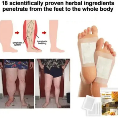 venvo Bee Venom Foot Patches Gentle Body Purify Aid (20 patches)(200 g)