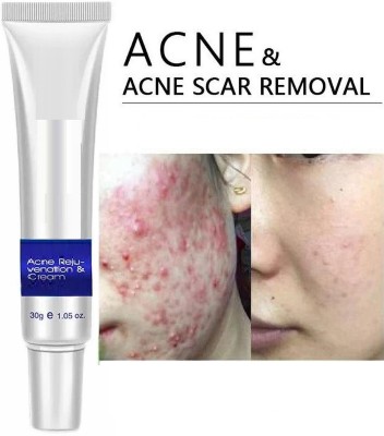 REIMICHI Acne Cream For Scars, Acne, Pores cream(30 g)