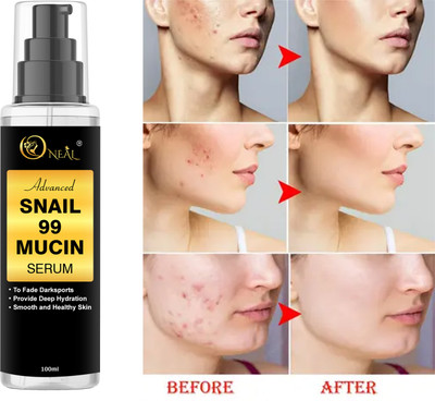 ONEAL Advanced Snail 99 Mucin power essence Serum - Snail Filtrate (Pack 1)(100 ml)