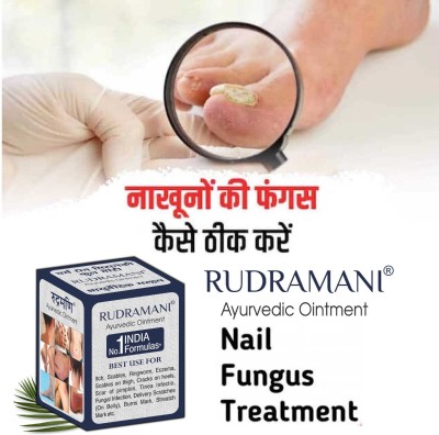 Rudramani Fungi-Nail Anti-Fungal Ointment, Nail Fungal Cream-Pack of -1(25 g)