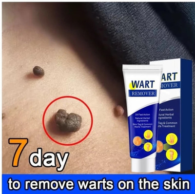 YAWI Best 8 Days Tags And Moles Remover Gel Men(100 g)