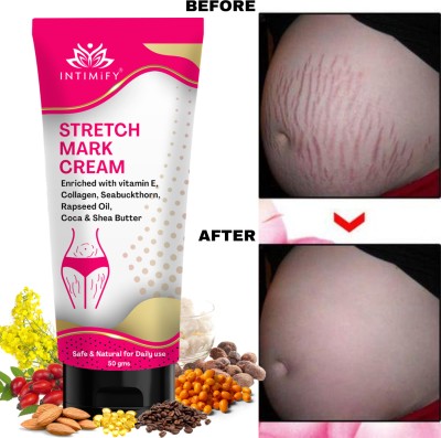 INTIMIFY Stretch Mark Cream For Women, Remove Pregnancy stretch marks Intimate Cream(50 g, Pack of 1)