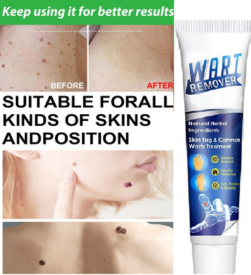 GFSU - GO FOR SOMETHING UNIQUE wart removal cream for face(100 g)