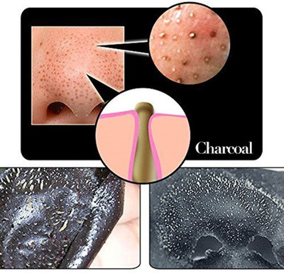 DARVING Deep Purifying Nose Strips for Women & Men(10 g)