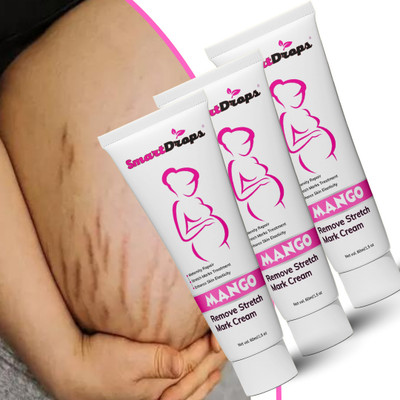 smartdrops Scar And StretchMarks Remove & give Smooth skin Cream Tube For Men & Women(180 ml)