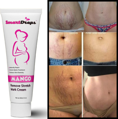 smartdrops ScarEase Solution For Men & Women(60 ml)