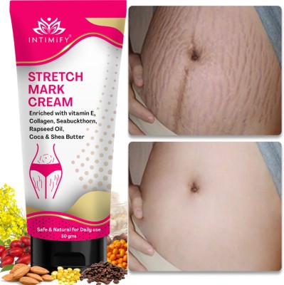 INTIMIFY Stretch Marks Removal Cream, Reduce Scar Before & After Pregnancy For Women(50 g)