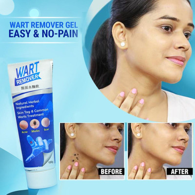 YAWI Warts Remover Cream Skin Face Body Tag Extract Corn Treatment(100 g)
