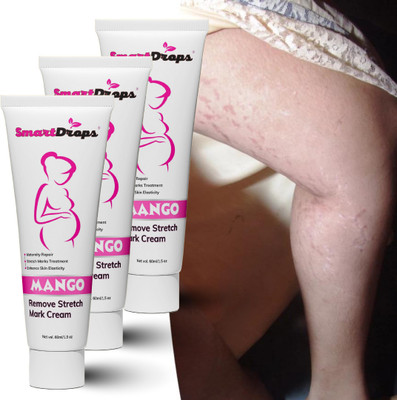 smartdrops StretchMarks And Scars Away Cream Tube(180 ml)
