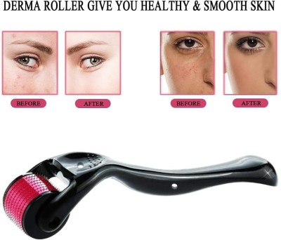 KPDREAMLAND derma roller hair 2.5 mm