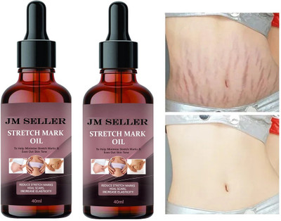 JM SELLER Stretch Marks oil for Pregnancy, Reduce Scars Before & After Pregnancy (P of 2)(80 ml)