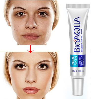 BIOAQUA ® Acne Treatment Anti ageing Faca(30 g)