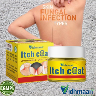 Vidhmaan Ayurvedic ItchCoat Anti fungal Malam - for Ringworm, itching, Eczema(25 g)