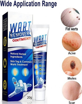 kHUDAt posh Wart Treatment Unique Cream Warts Remover Ointment Skin Tag Removal(GOA)(20 ml)