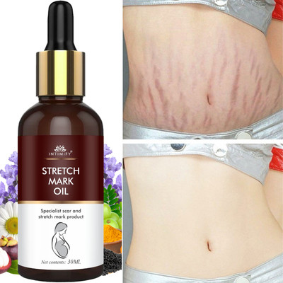 INTIMIFY Stretch Marks oil for Pregnancy, Reduce Scars Before & After Pregnancy(30 ml)
