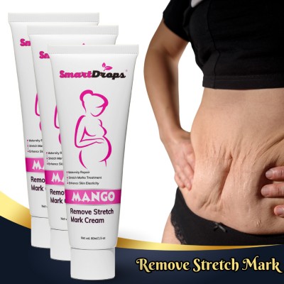 smartdrops Stretch Marks Removal Cream for Pregnancy with the Goodness(180 ml)