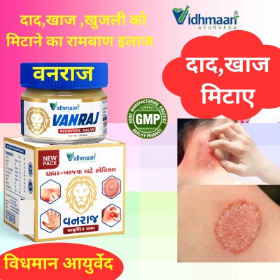 Vidhmaan Ayurvedic VANRAJ Fungal Mor Balam body Skin Treatment(25 g)