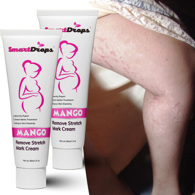 smartdrops After Pregnancy stretch mark & scar removal Tube(120 ml)